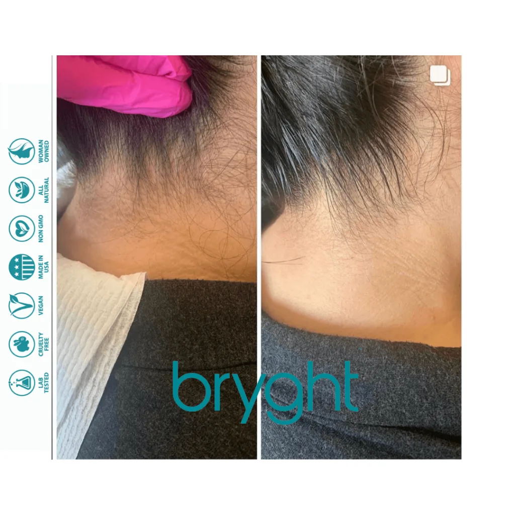 Bryghtenup Skin Brightening Work Showcase 10
