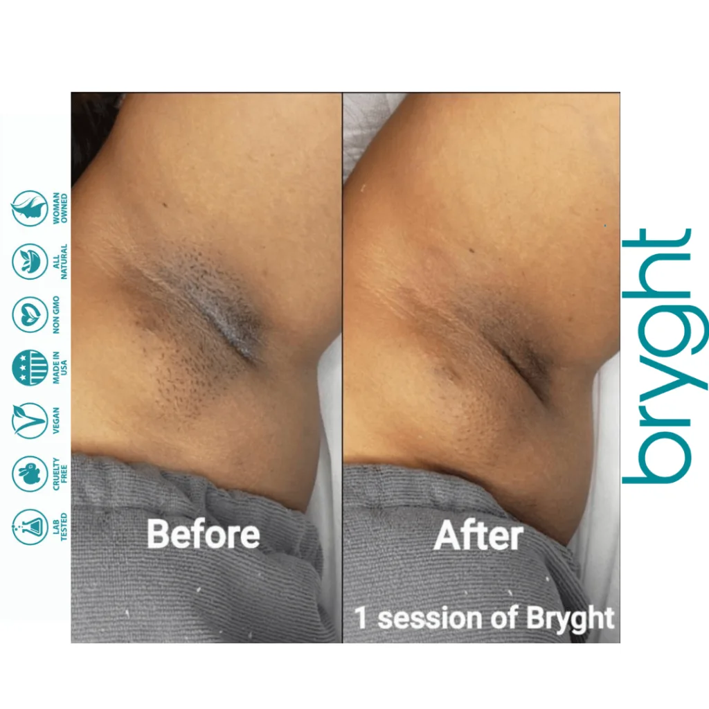 Bryghtenup Skin Brightening Work Showcase 11