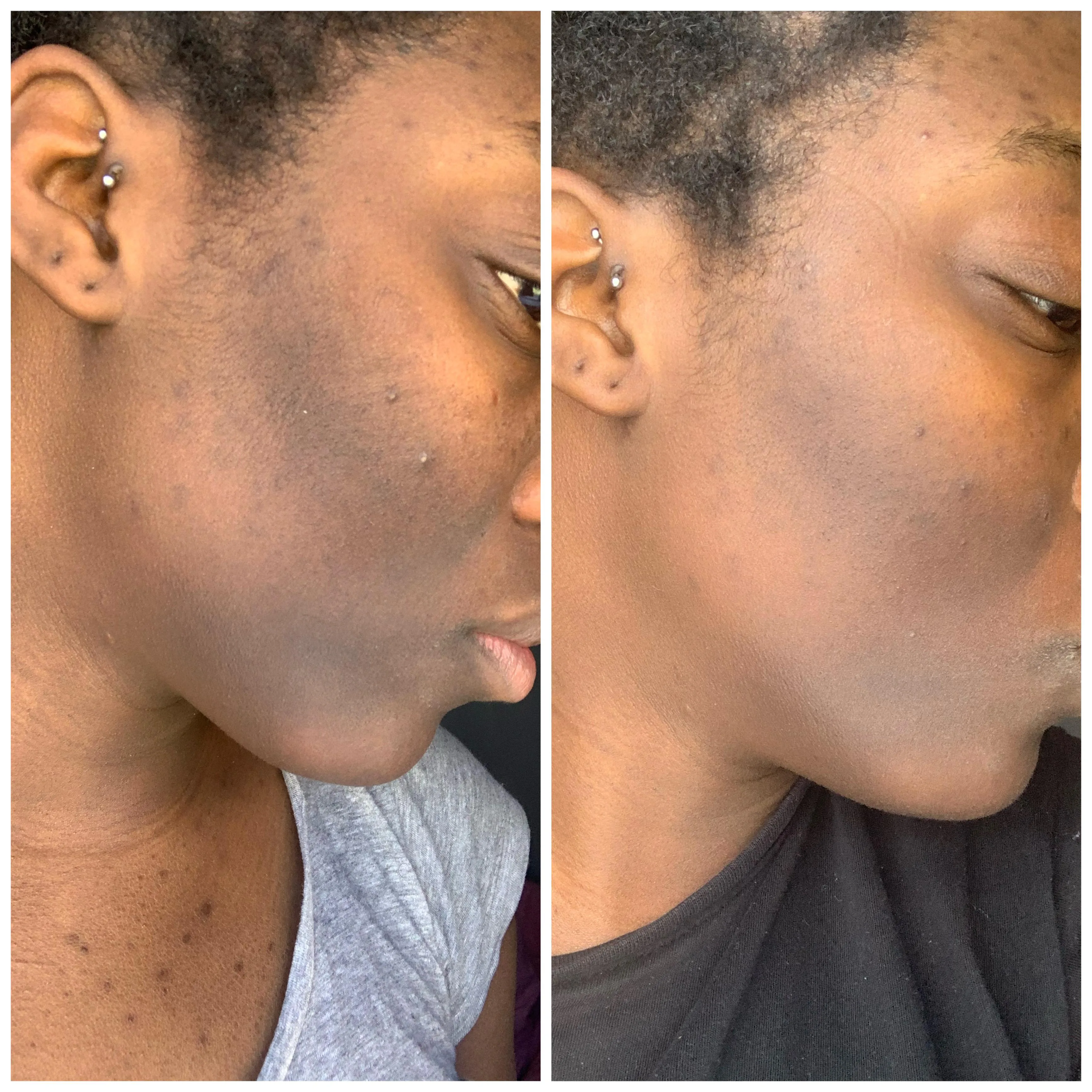 Bryghtenup Skin Brightening Work Showcase 3