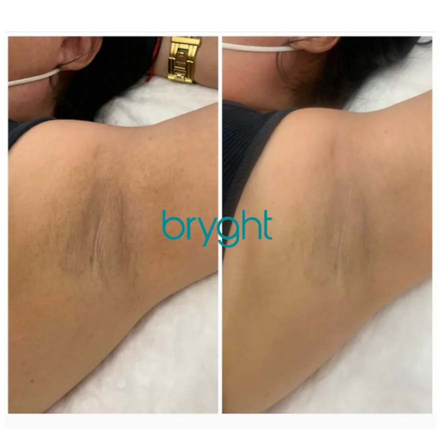 Bryghtenup Skin Brightening Work Showcase 4