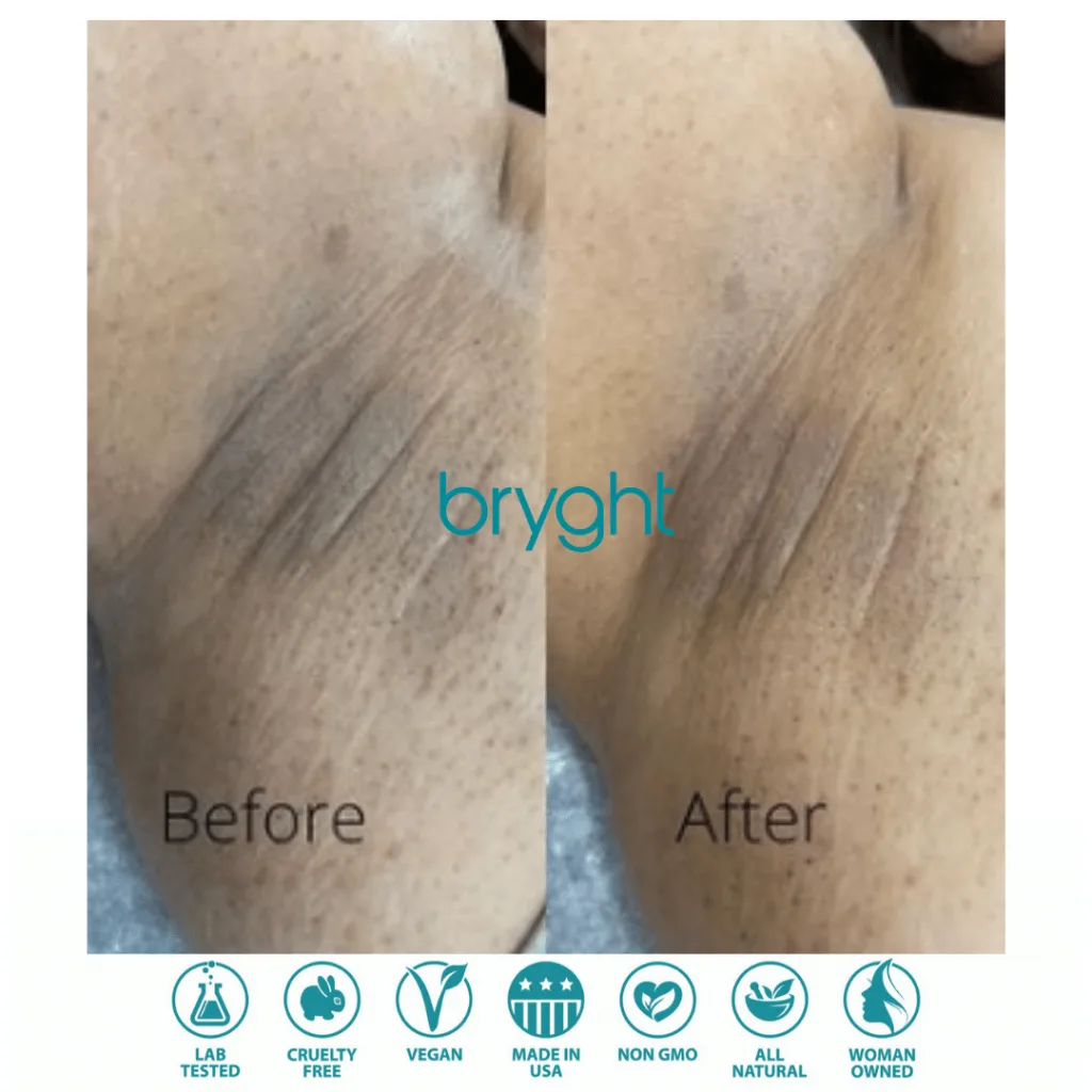 Bryghtenup Skin Brightening Work Showcase 5