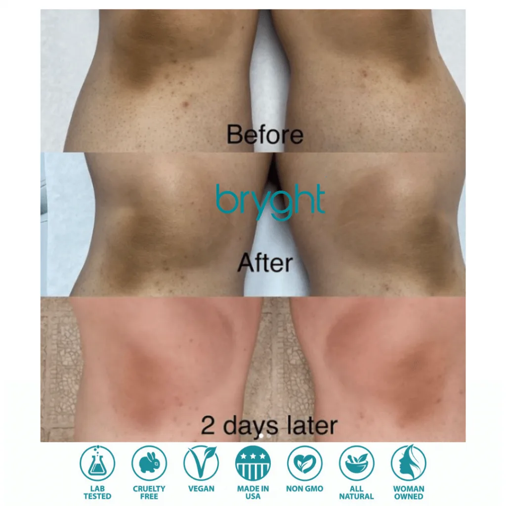 Bryghtenup Skin Brightening Work Showcase 6
