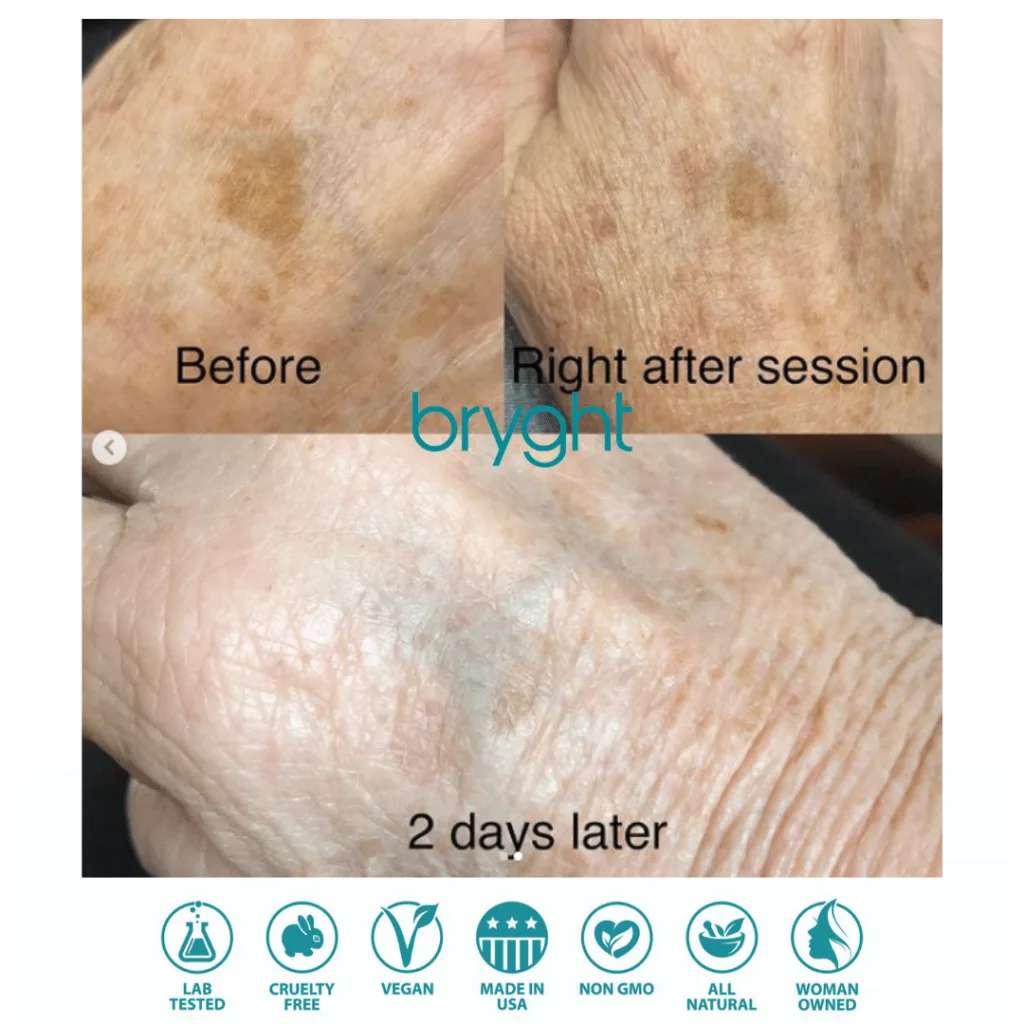 Bryghtenup Skin Brightening Work Showcase 7