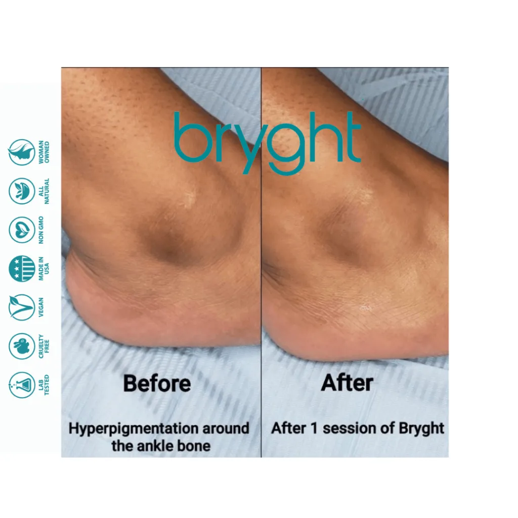 Bryghtenup Skin Brightening Work Showcase 8
