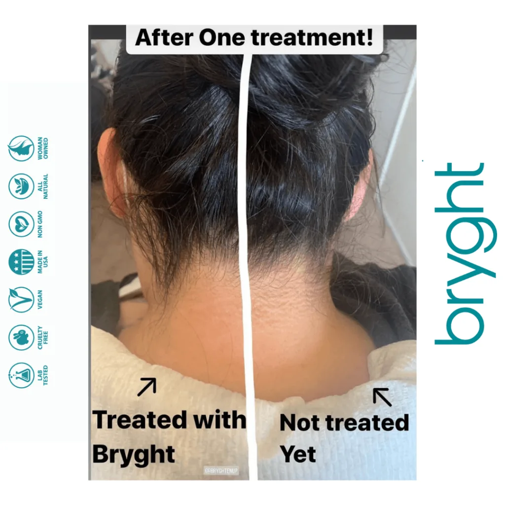 Bryghtenup Skin Brightening Work Showcase 9